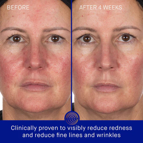 The Hydrogel Face Mask
