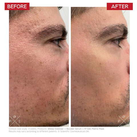 Booster Serum