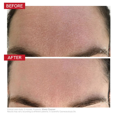 3Deep Micro-Resurfacing Cell Renewal Cleanser