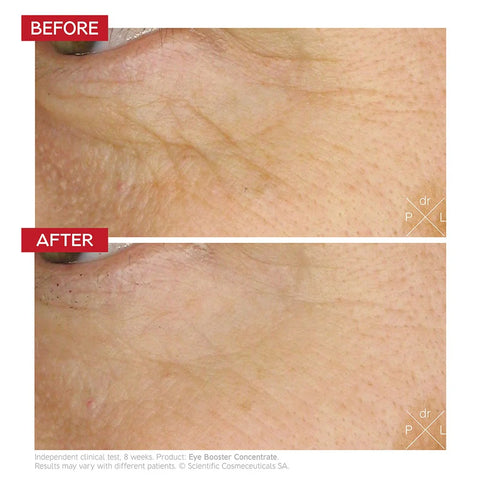 Eye Booster Concentrate