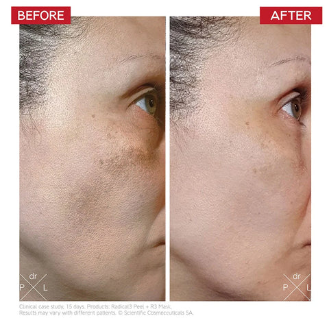 R3 Cell Matrix Mask