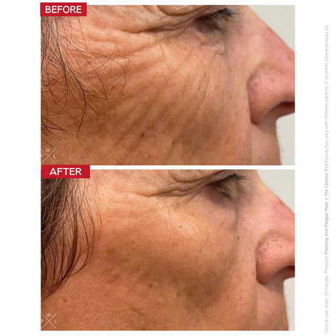 The Contour Pro